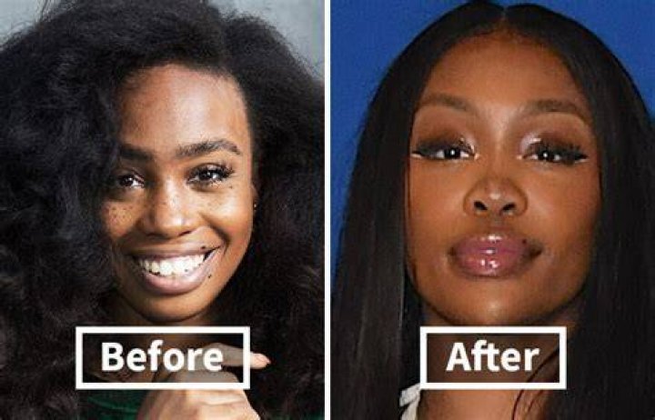 A tweet showing SZA before and after possible surgery.
