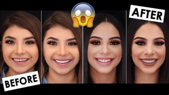 Alondradessy Before BBL | Plastic Surgery Transformation