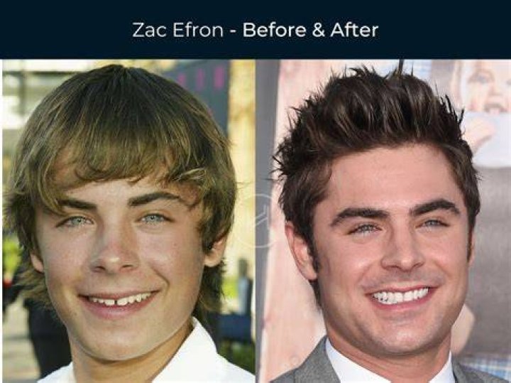 Before and After Photos