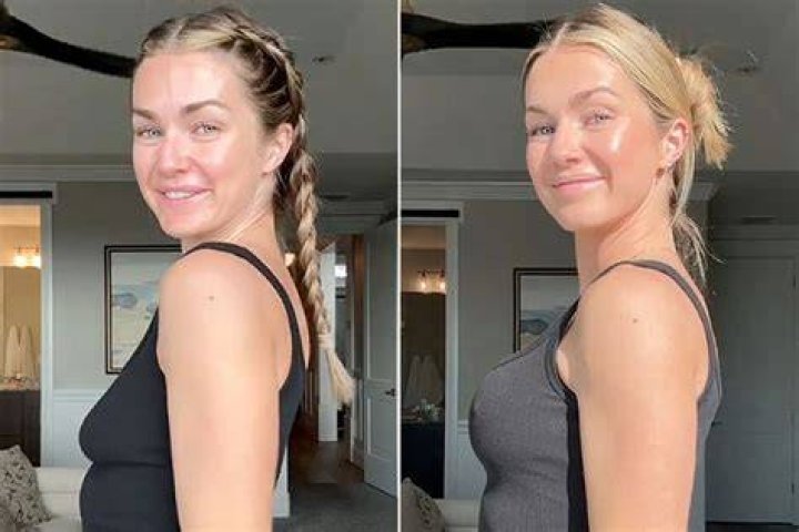 Has She Done Breast Augmentation In 2023?