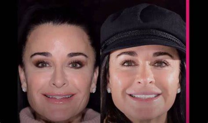 Kyle Richards’ Teeth Makeover Explained by Her Dentist